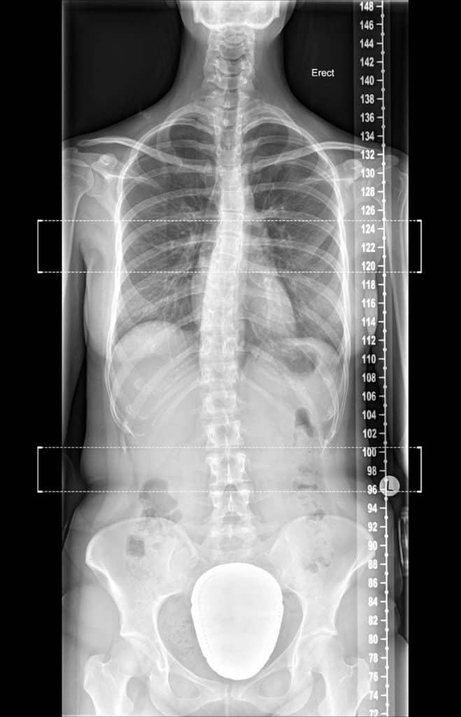 Bulk Billing X-rays Melbourne | Melbourne Radiology Clinic